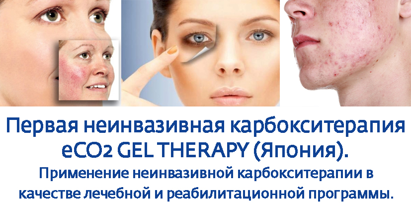 Неинвазивная карбокситерапия еCO2 GEL THERAPY (Япония) Применение неинвазивной карбокситерапии в качестве лечебной и реа билитационной программы в   косметологии. Отработка практических навыков СО2 терапии по схеме: коллега-коллеге.