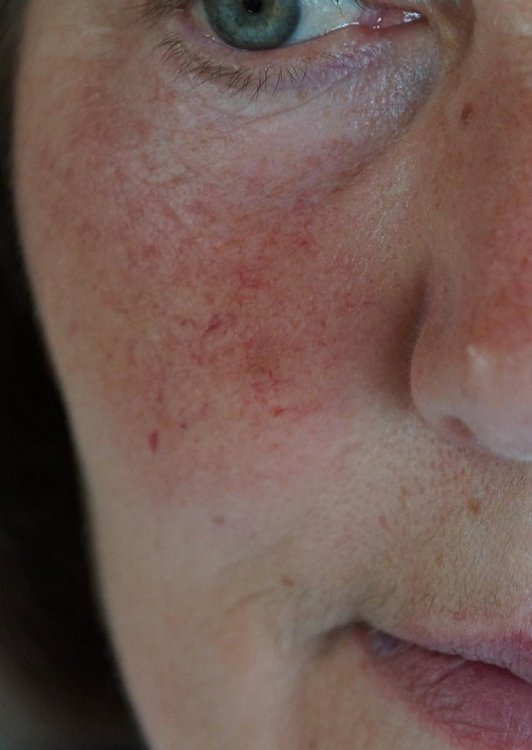 Через 10 недель.jpg